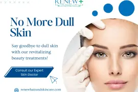 Skin Treatment in Madurai - Renew Hair and Skin Care