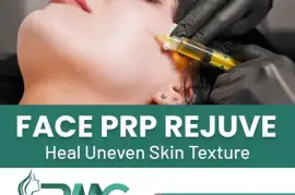 PRP Treatment For Face in Islamabad -Rehman Medical Center
