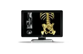 Medical Diagnostic Display: Enhancing Healthcare Imaging Solutions