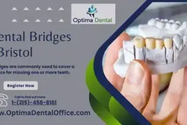 Restore Your Smile with Precision Dental Bridges in Bristol from Optima Den