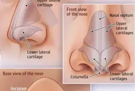 Breathe Easy Look Great: Comprehensive Rhinoplasty Care