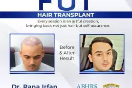 BEST FUT HAIR TRANSPLANT IN ISLAMABAD 