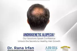 Best Androgenetic Alopecia In Islamabad